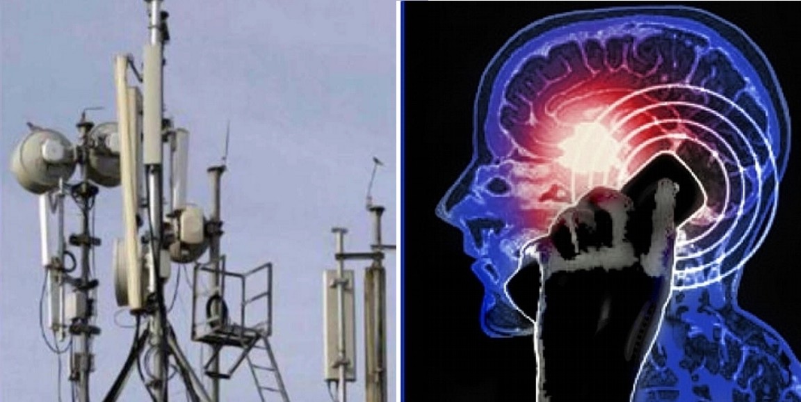 Headache and epilepsy issues in Salmiya due to Telecom tower