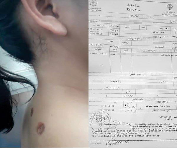Legal action pressed against and Ministry of Interior staff for abusing Filipina maid