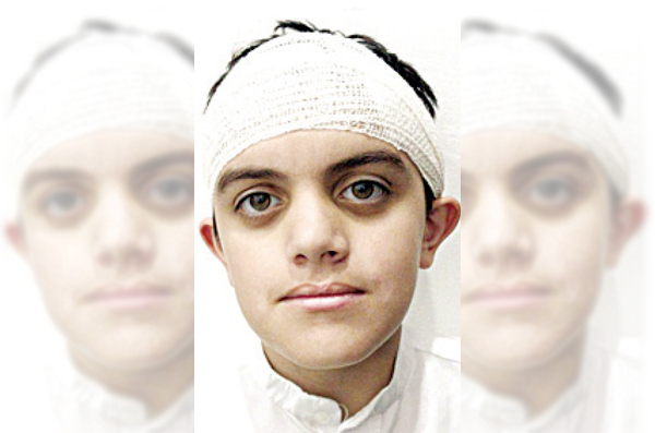 Kuwaiti teacher accused of assaulting special needs boy