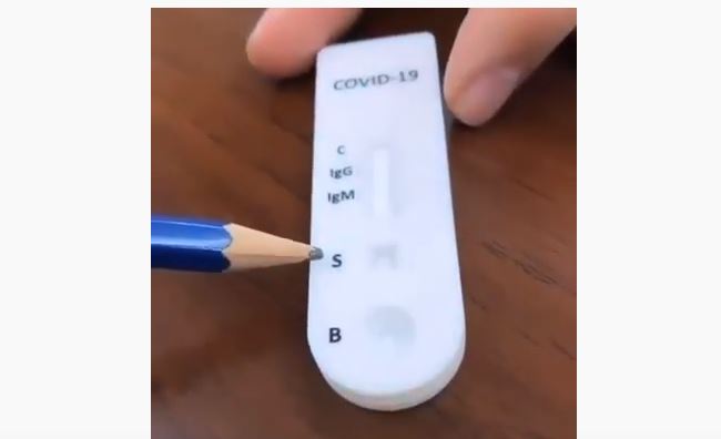 Coronavirus test in 10 minutes